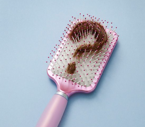 Hair Loss in Your 20s