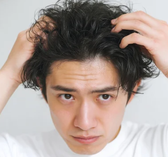 Mens Hair Loss Treatment Singapore
