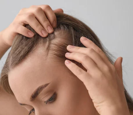 Stress Hair Loss Singapore