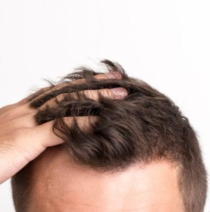 anti hair loss shampoo for men