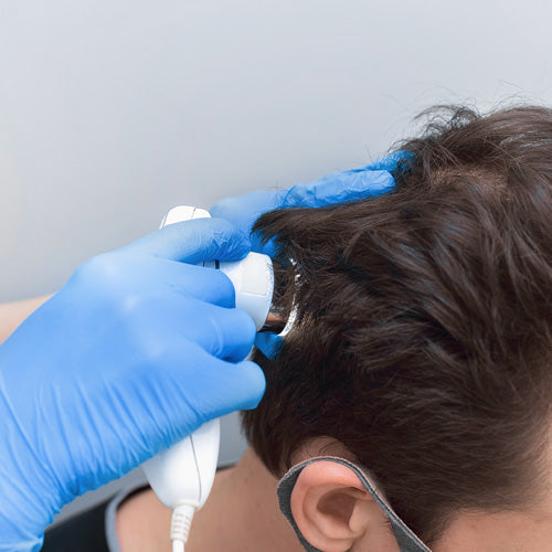 hair loss in 30s and 40s