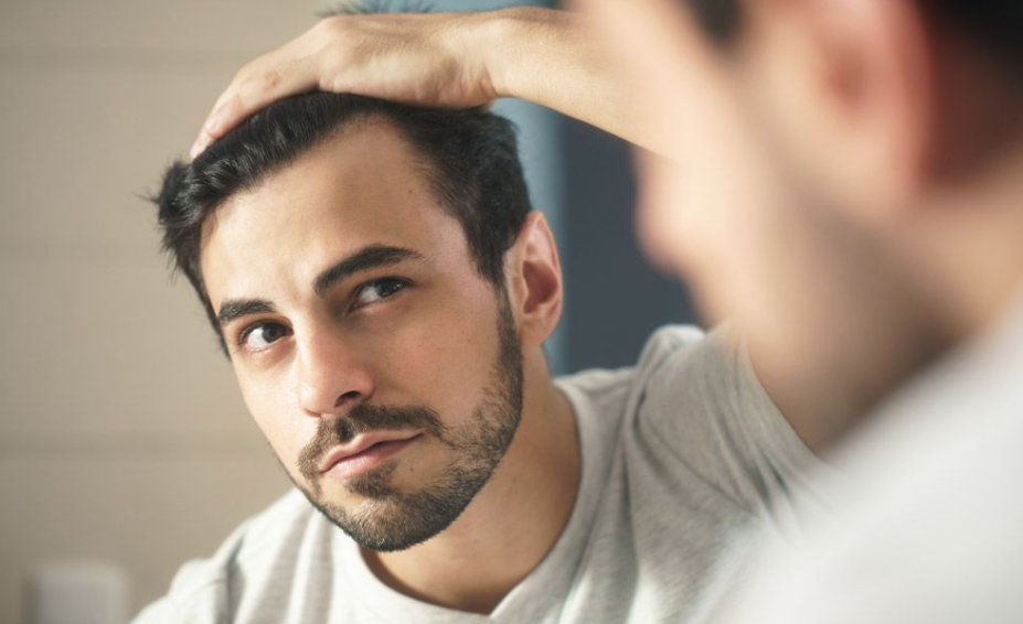 hair loss men Singapore DHT
