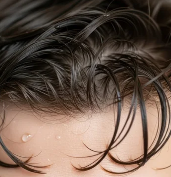 humidity hair loss Singapore 
