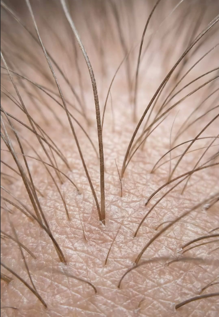 hair growth cycle
