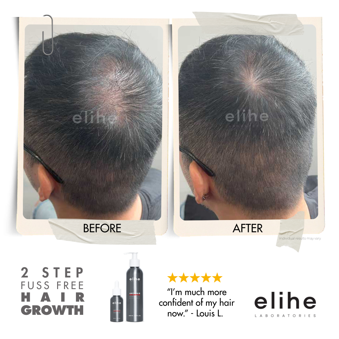 elihe Bioscience Duo